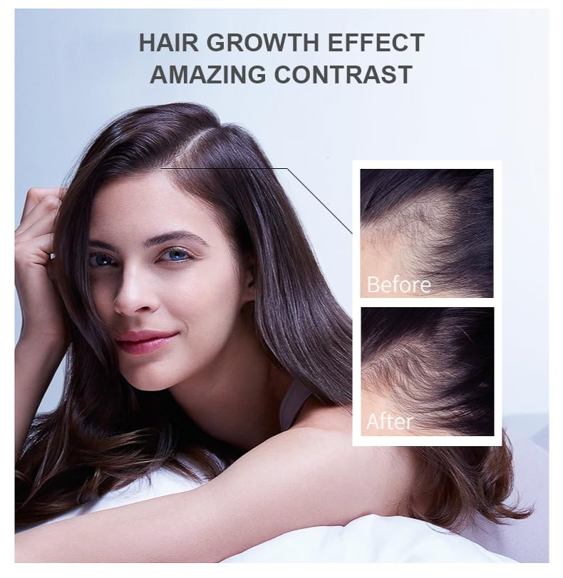Hair Growth Oil Ginger Biotin  - Hair Care Fragrance Essential Oil ulasan dan harga