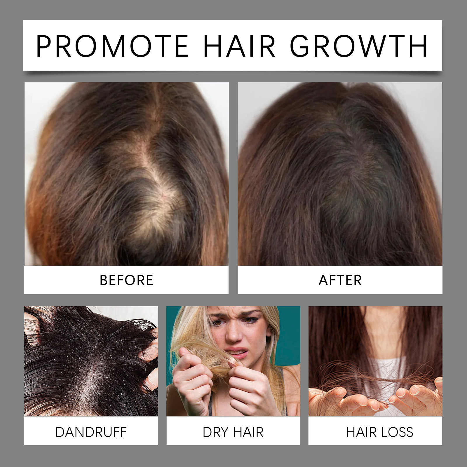30ml Hair Care Essential Oil T - Hair Care Essence ulasan dan harga