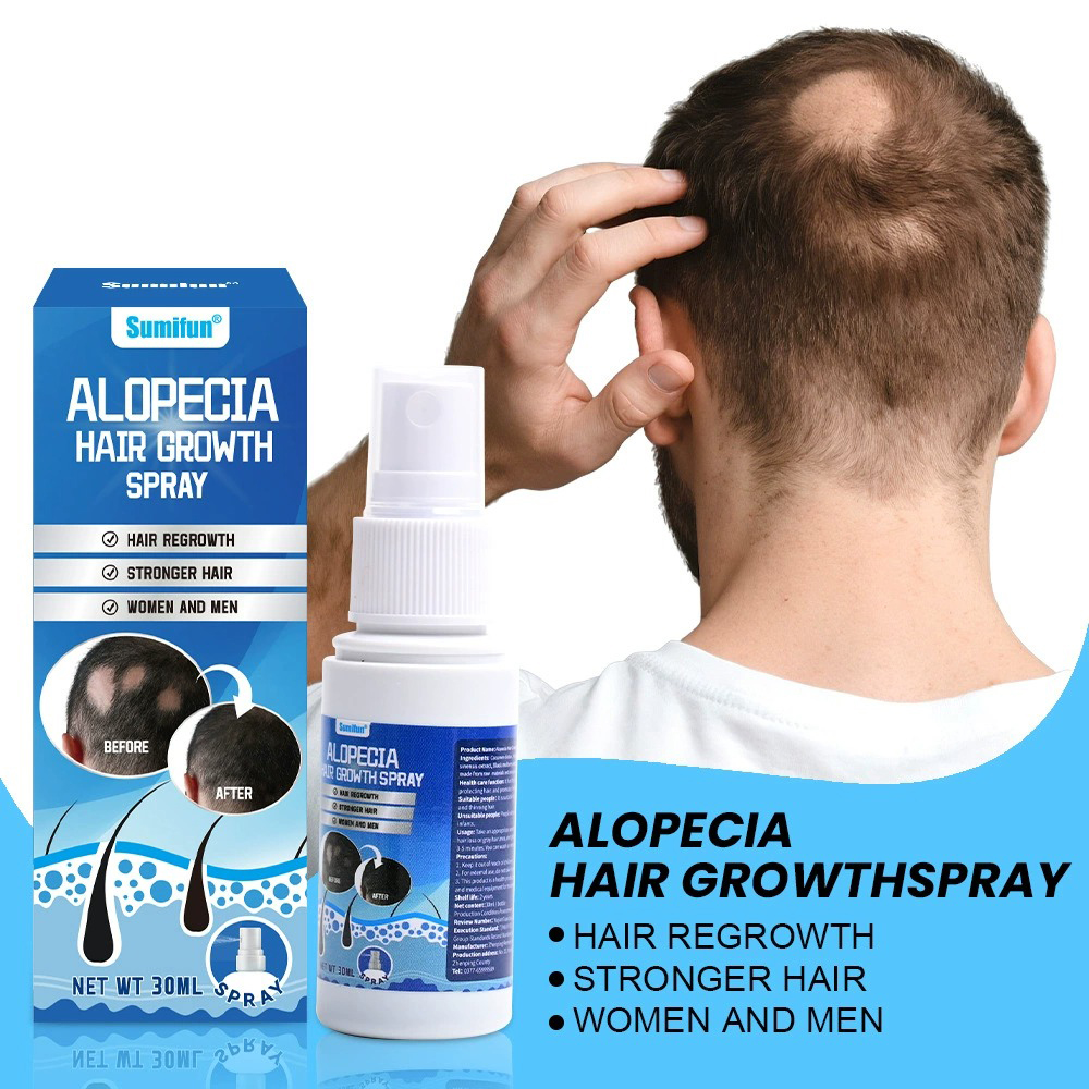 Alopecia Hair Growth Spray Sop - Hair Care Essence ulasan dan harga