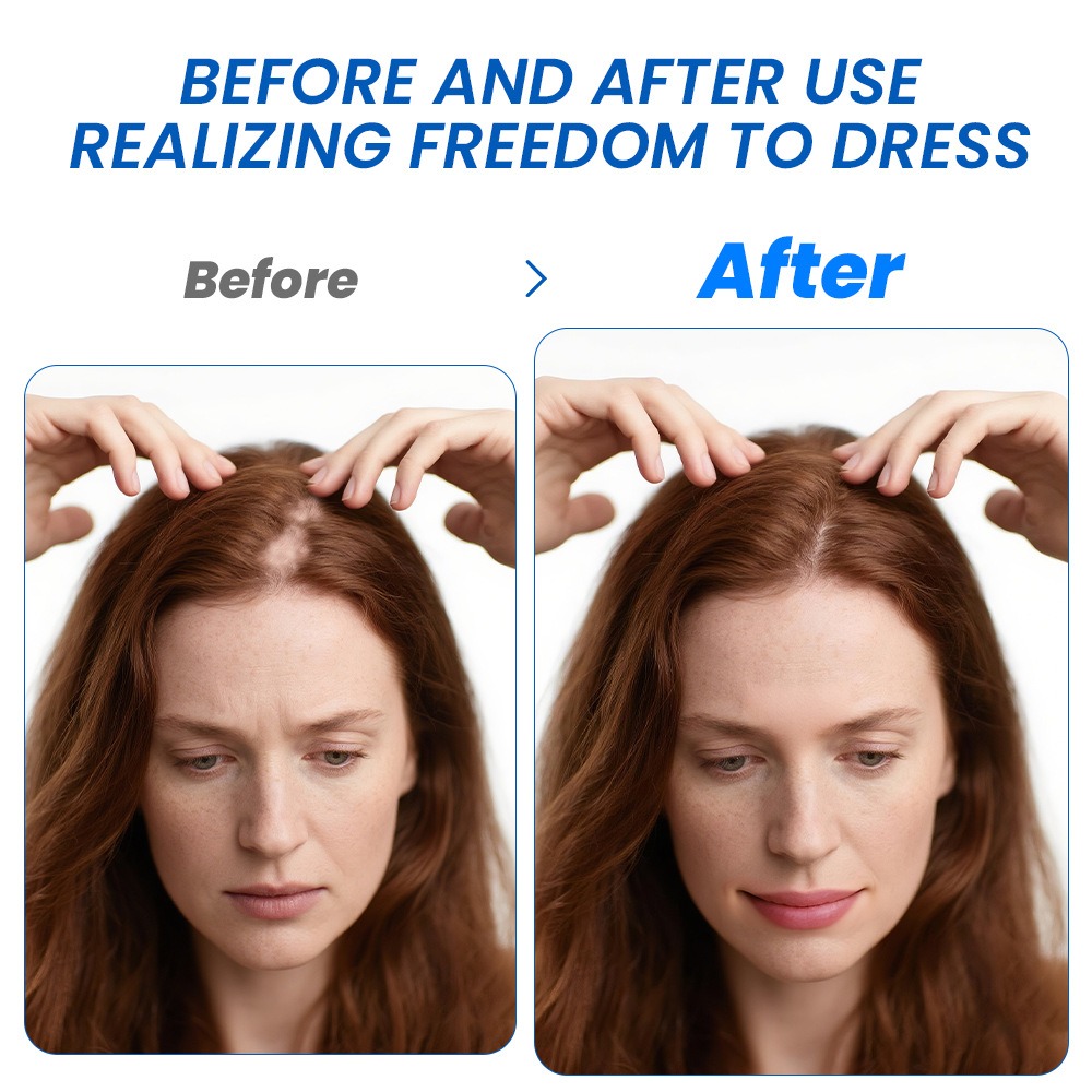 Alopecia Hair Growth Spray Sop - Hair Care Essence ulasan dan harga