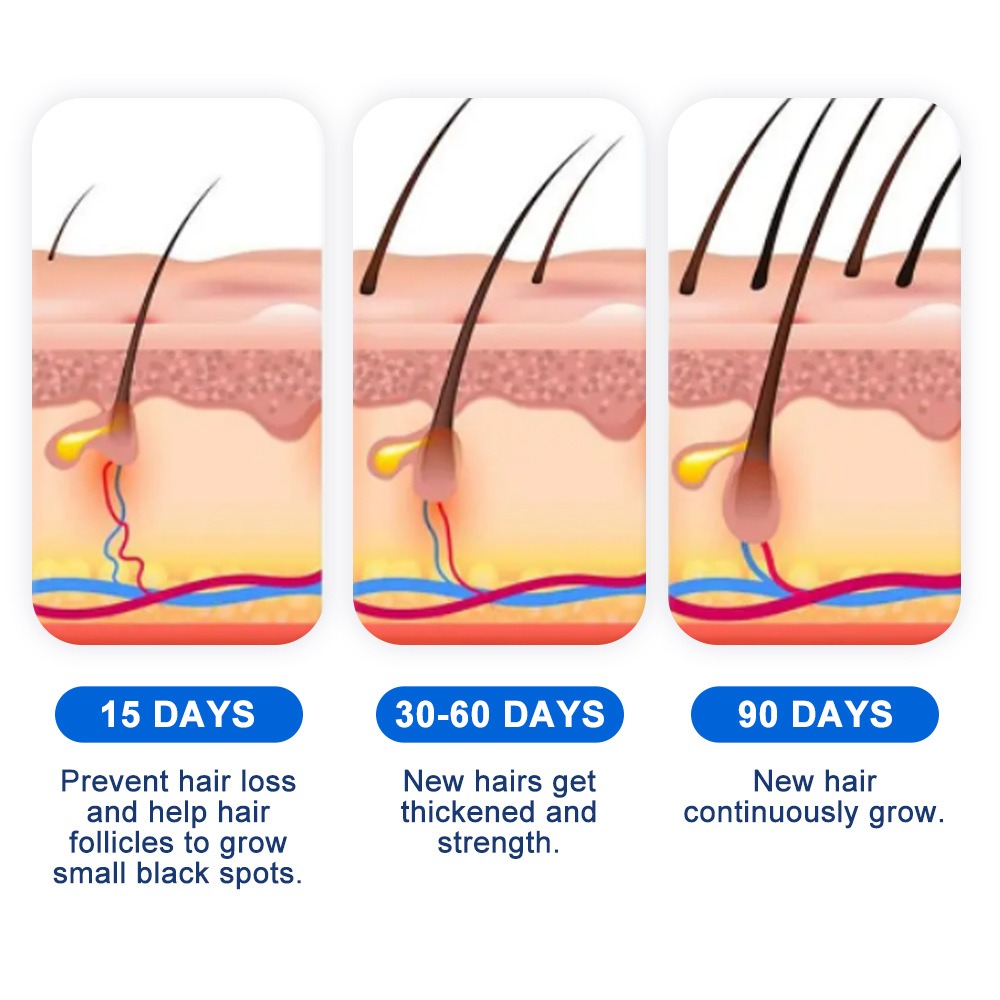 Alopecia Hair Growth Spray Sop - Hair Care Essence ulasan dan harga