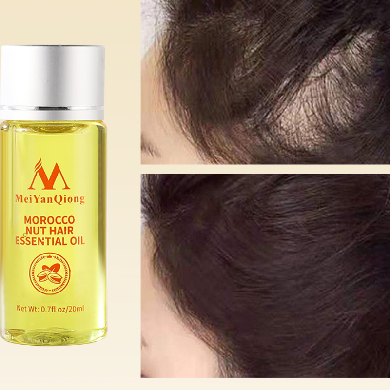 20ML Essential Oil for Hair Gr - Hair Care Fragrance Essential Oil ulasan dan harga