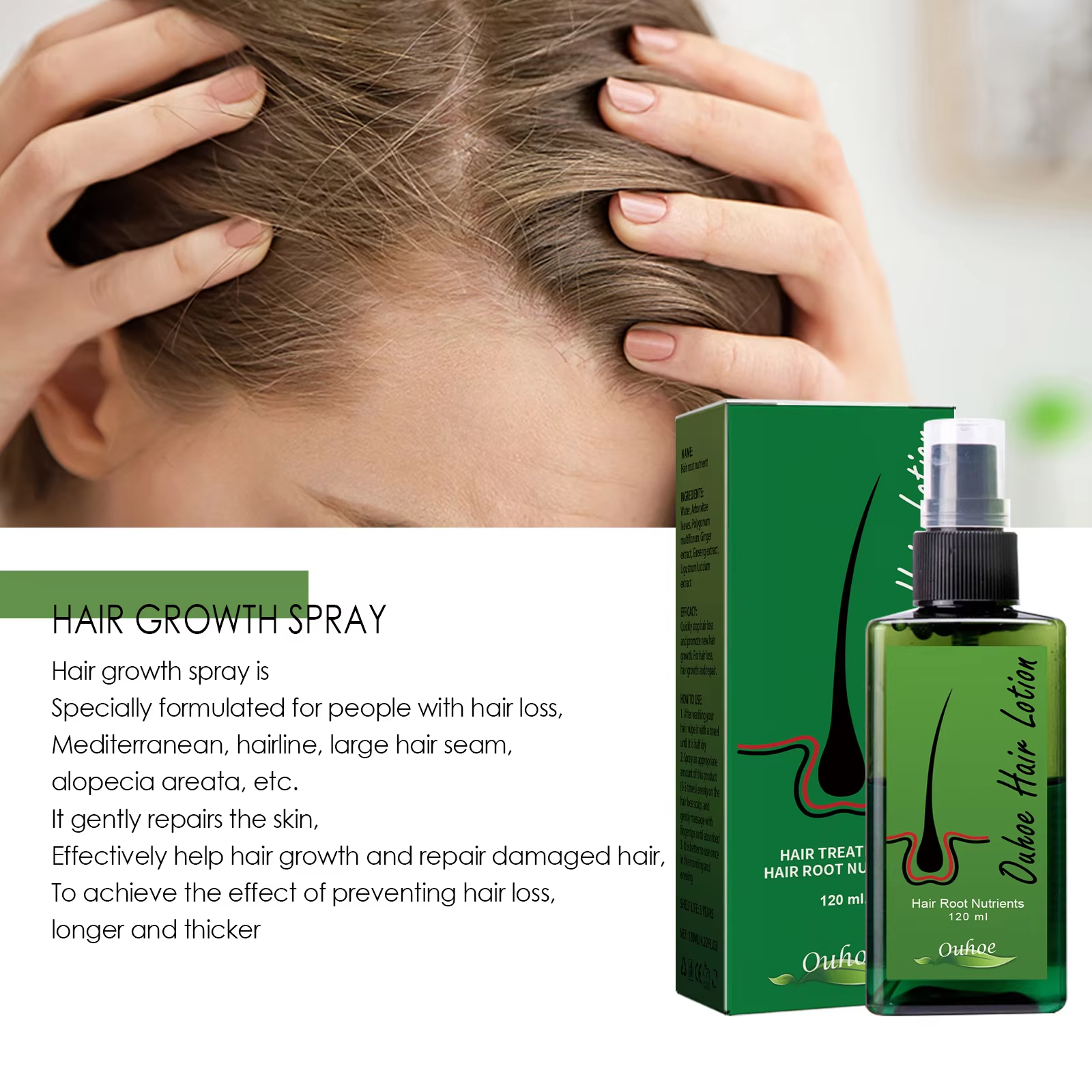 Hair Growth Spray Anti Hair Lo - Hair Care Essence ulasan dan harga