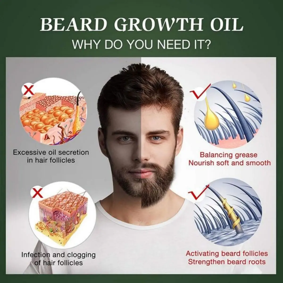 Fast Beard Growth Oil Beard Oi - Hair Care Fragrance Essential Oil ulasan dan harga