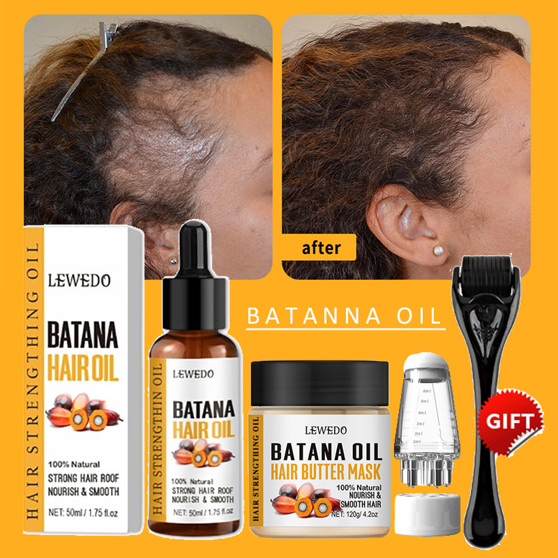 Batana Oil Hair Growth Kit Tra - Hair Care Dupes ulasan dan harga