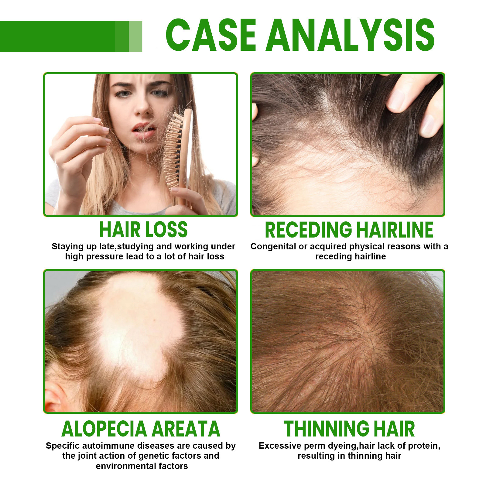 Hair Growth Oil Spray Repair D - Hair Care Essence ulasan dan harga
