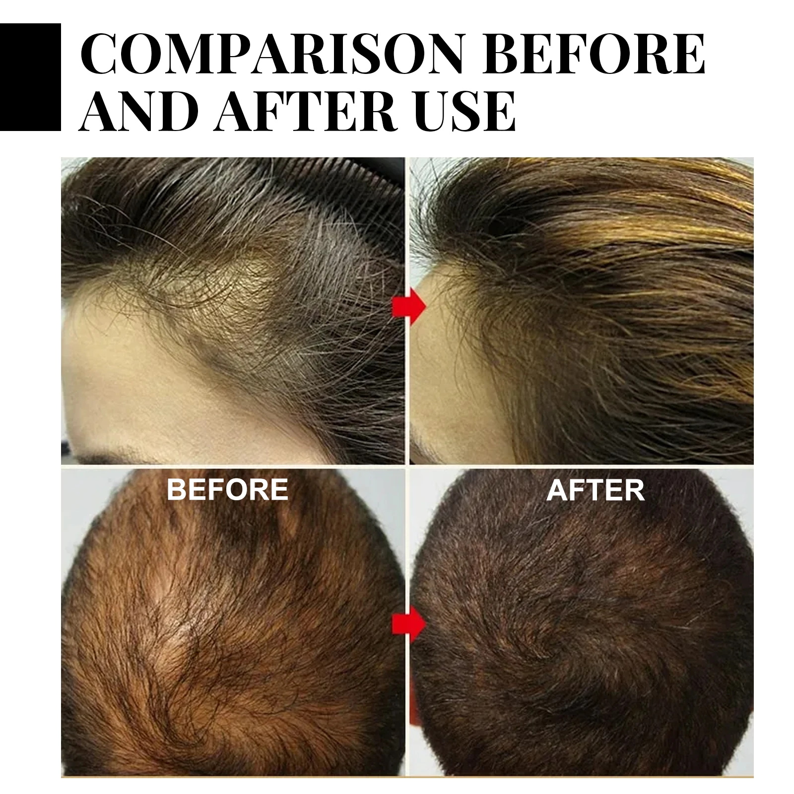 Ginger Hair Growth spray Anti  - Hair Care Essence ulasan dan harga