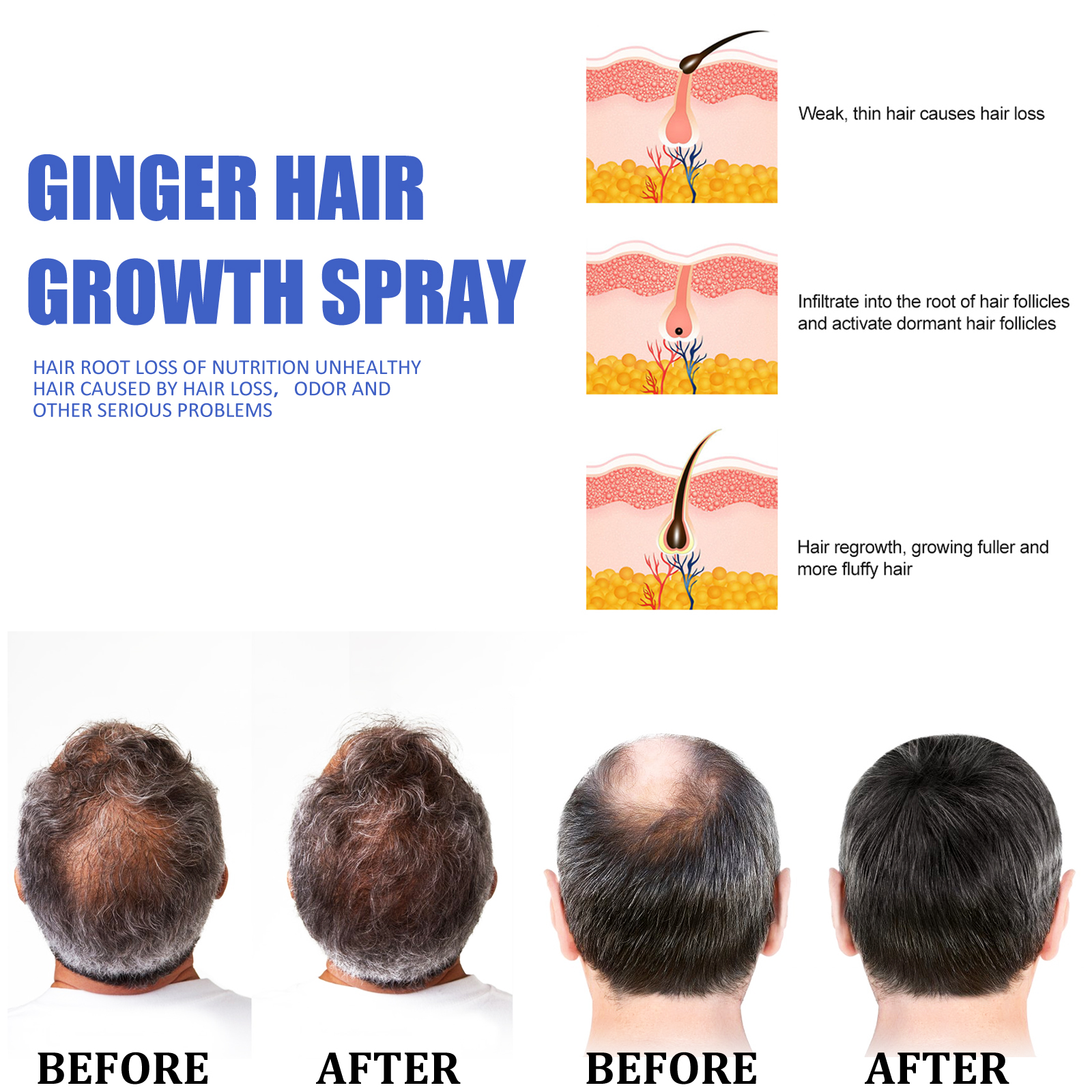 Ginger Hair Growth spray Anti  - Hair Care Essence ulasan dan harga