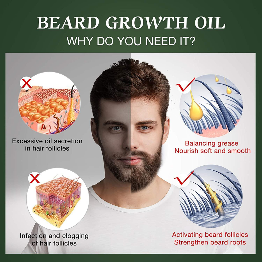 Fast Beard Growth Oil Beard Oi - Hair Care Fragrance Essential Oil ulasan dan harga